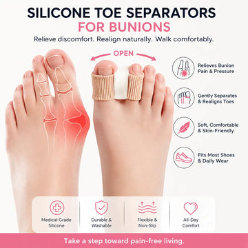 Silicone toe spacers for bunions showing gentle toe separation and alignment