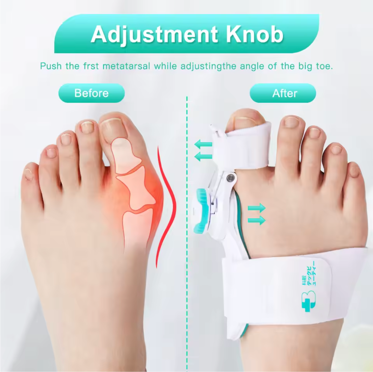 AlignEase™ Toe Corrector | Bunion & Toe Alignment Support