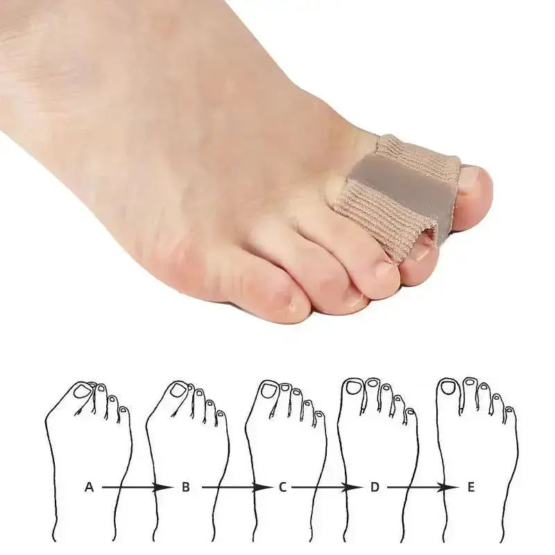 Gel bunion corrector and toe separator from HealArch™ for foot pain relief, designed to realign toes and reduce discomfort.