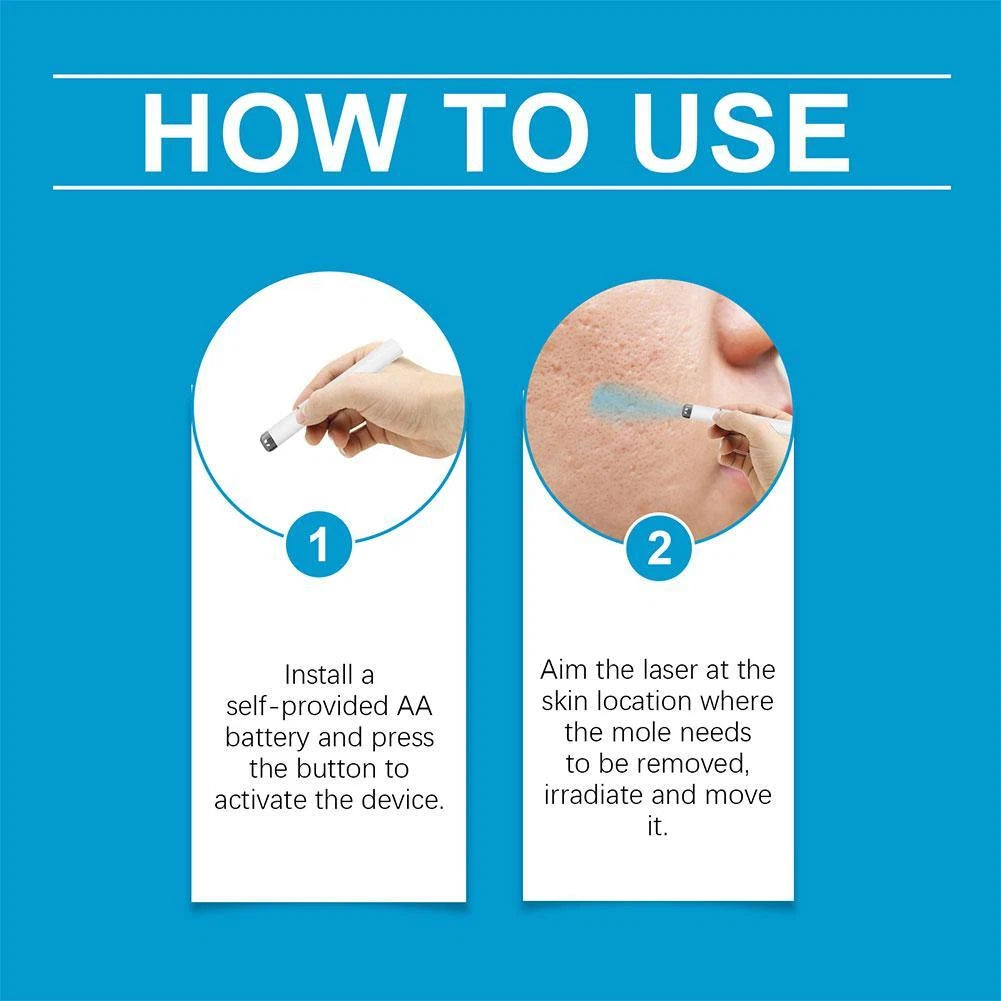 Mole & Wart Removal Laser Pen